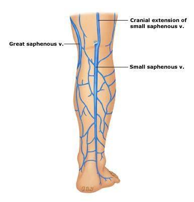 BEFORE, Stripping was the most common procedure performed and was done to remove all or part of the greater saphenous vein or small saphenous vein.