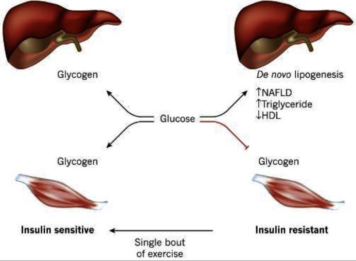 Insulin Resistance KD diet has been found to result in insulin resistance which increases hepatic lipid content Increased diacylglycerol (DAG) content increased protein kinase C(PKCε) activation