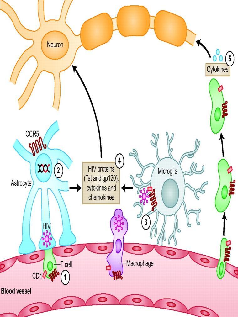 4 HIV-infected astrocytes and microglia cause neuronal injury indirectly by releasing soluble toxic viral proteins (Tat and gp120) and pro-inflammatory molecules (cytokines and chemokines) 5