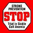 STOP trial Standard Care Transfusion 67 patients 63 patients 11 strokes 1 stroke 130/ 1934 HbSS children with TCD >200cm/s 92% risk reduction <0.