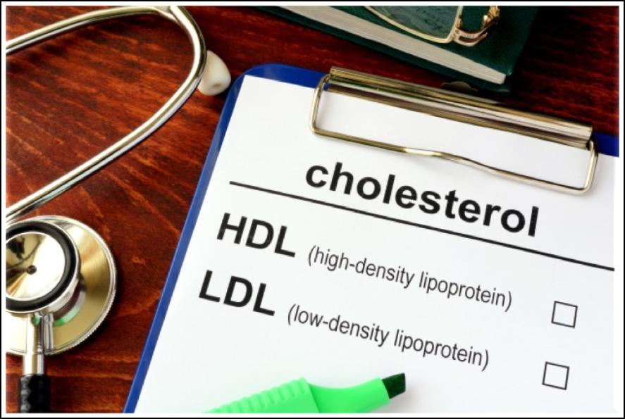 High Cholesterol Two important types of cholesterol LDL ( bad ) HDL ( good ) Statin medications: goal is primarily to get the LDL lower