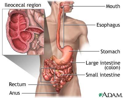 Historically the disease was thought to be more common in western population, but more recently the incidence and prevalence of Crohn's disease is increasing in developing countries of Asia and