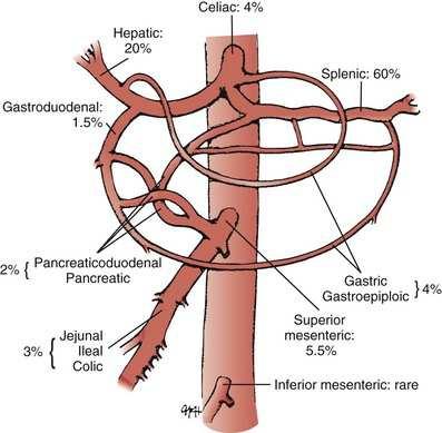 Visceral Aneurysm Splenic artery 60 % Hepatic artery 20% Superior mesenteric artery (SMA) 5,5% Celiac artery 4%