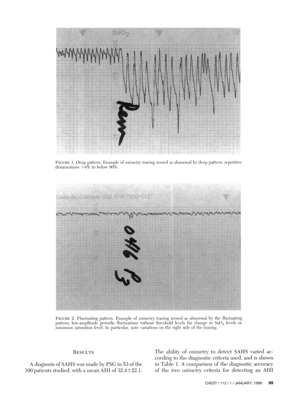 Figure 1. Deep pattern. Example of oximetry tracing scored as abnormal by deep pattern; repetitive desaturations >4% to below 90%. Figure 2. Fluctuating pattern.