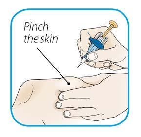 Step 5: Inject Your Dose of ORENCIA Hold the body of the prefilled syringe in your hand using your thumb and