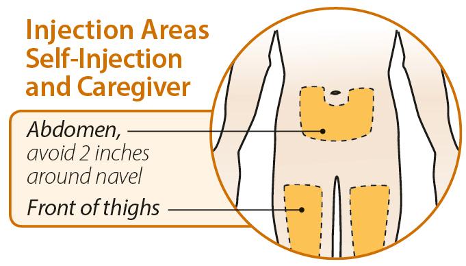 Step 2: Prepare for Injection Choose your injection site in either the stomach (abdomen), front of the thighs, or outer area of upper arm (only if caregiver