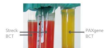Prevention of Red Blood Cell Lysis During