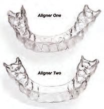 All cases are digitally scanned and teeth are reset using the