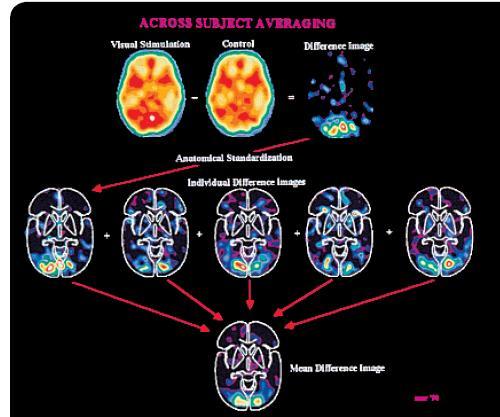 Imaging the Brain 2 Imaging methods can also be used to reveal functional organization in the living brain.