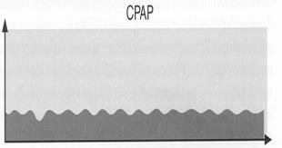 CPAP Druk (P) P=+8cmH2O P=atm in uit BPAP Druk