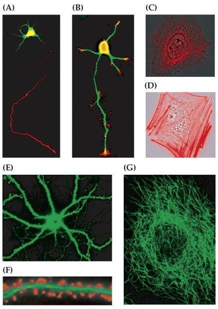Distinctive arrangements of cytoskeletal elements in neurons A: Tubulin: (G) cell body, axon, dendrites Tau: (R)