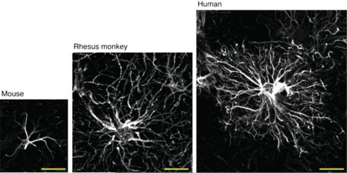human astrocytes are larger and more complex than rodent and other