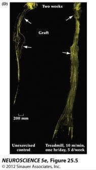Proximal axon stump transforms