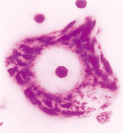 Cresyl violet Cajal s silver nitrate staining 그림 2-2 그림 2-3 Nissl substance: rer Axon Nucleolus