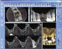 Planmeca Romexis software has optional DICOM functionality, which allows 3D studies to