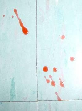 stain Patterns The harder and less porous the surface, the less the blood drop will break apart.