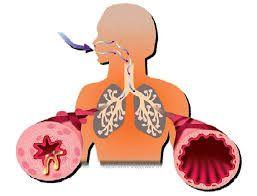 Asthma causes recurring periods of wheezing (a