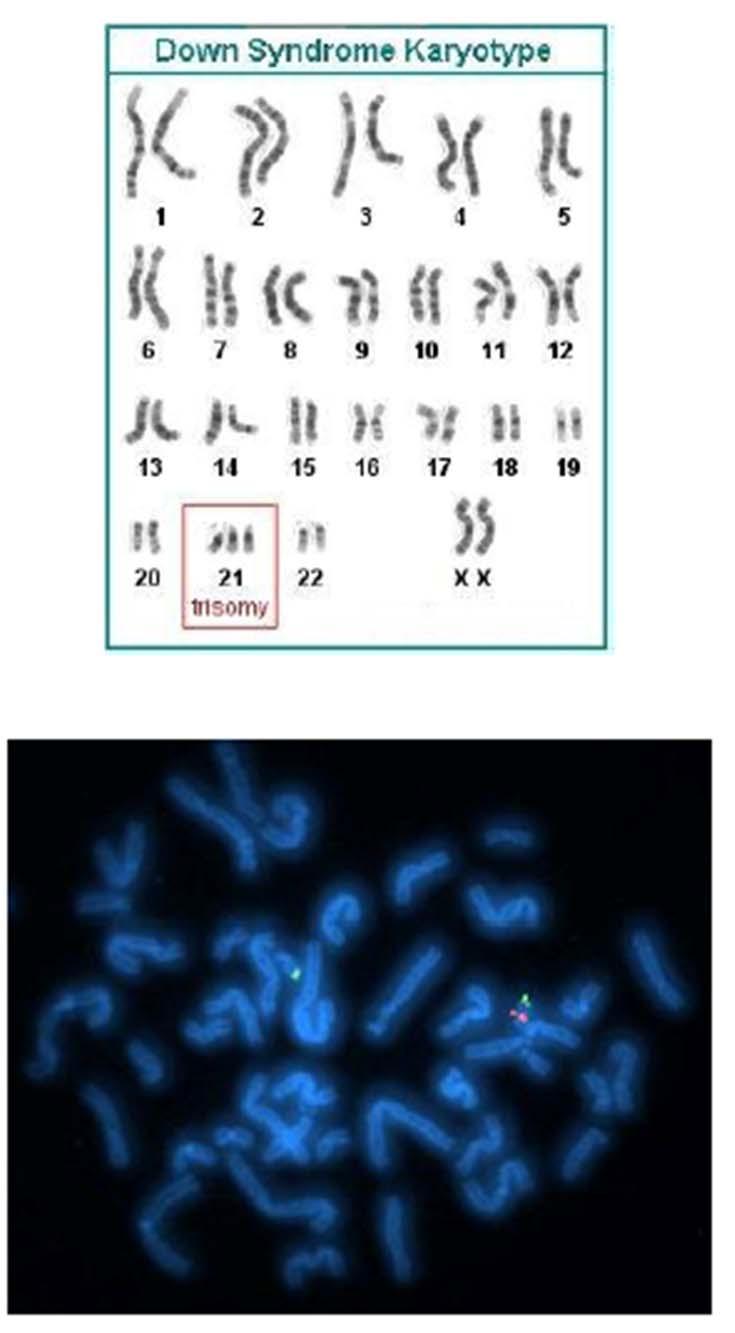 Traditional Cytogenetic Testing Karyotype Aneuploidy, translocations, rearrangements Large deletions / duplications (>5Mb) Fluorescent in situ hybridization