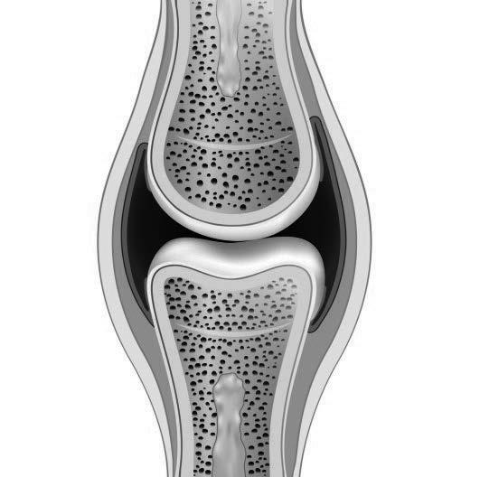 13 Fig. 13.1 shows a diagram of a synovial joint. 6 Fig. 13.1 Identify two structures of the joint and explain their functions.