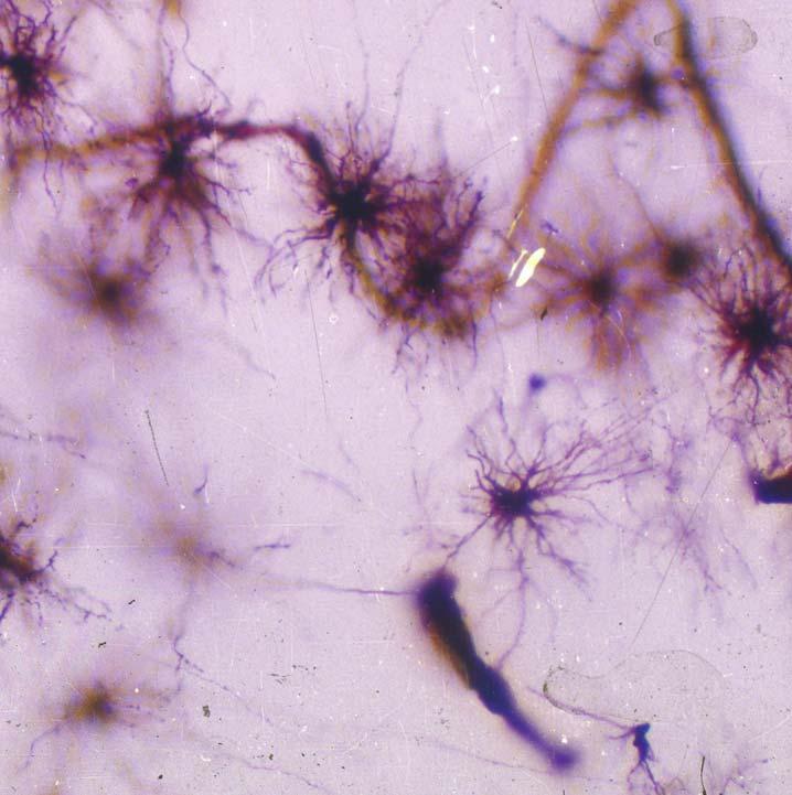 3.1.1 Astrocytes pia mater cerebellum Astrocytes capillary the largest