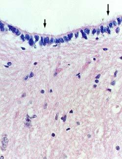 3.1.4 Ependymal cells simple cuboidal or columnar epithelial cells distribution: ventricle of brain and central canal of spinal