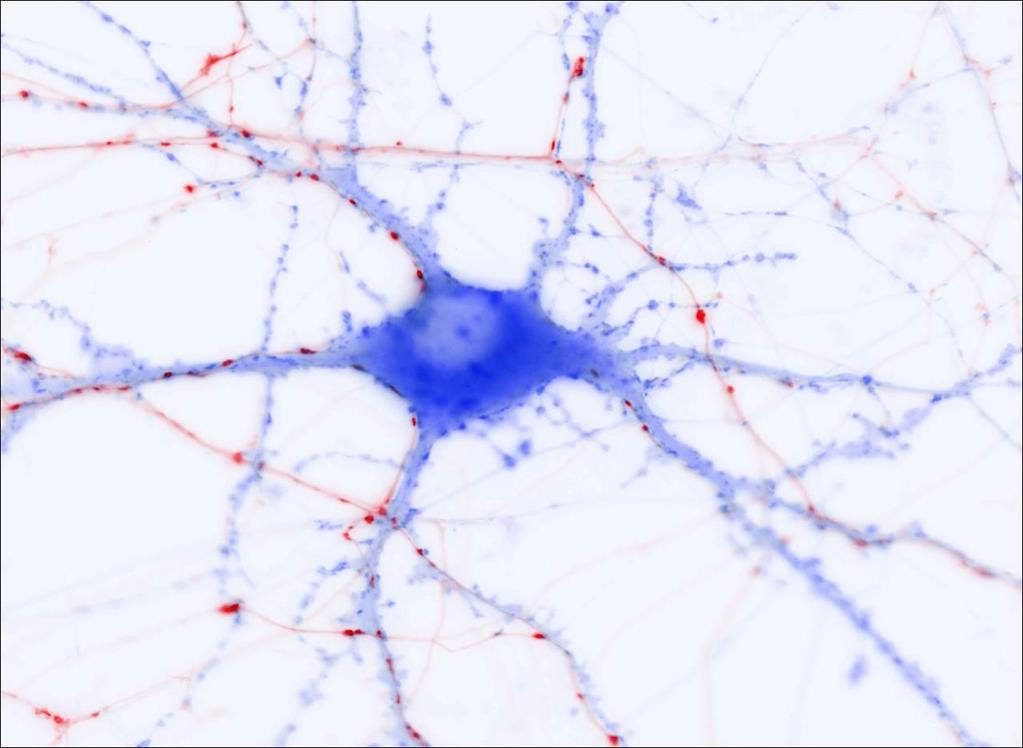 Brain is comprised of networks