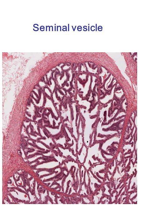 Glandular epithelium of seminal vesicles normally varies Musosa arranged into convoluted folds lined by secretory