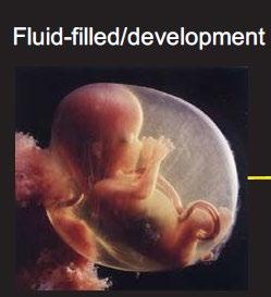 The Role of the Fetal Lung In Utero The fetal lung is not involved in gas exchange Gas exchange performed by the placenta Lung is fluid filled High pulmonary vascular resistance with only