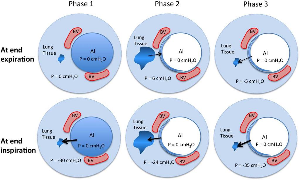 Respiratory Transition at Birth: A Three-Phase Process Hooper et al. ADC F&N ed.