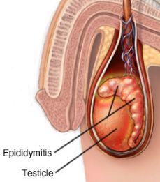 Epididymis a compact coiled tube attached to the outer edge of the testis sperm cells are produced in the testes but are stored, and mature in the epididymis