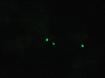 Cells were re-suspended in 100 µl and aliquots combined 1:1 (volume to volume). This mixed extract was applied to both a clean microscope slide and to a SPERM HY-LITER slide.