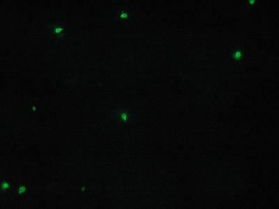 Processed slides were visualized using phase contrast and fluorescence microscopy: sequential photomicrographs of the identical microscope field with