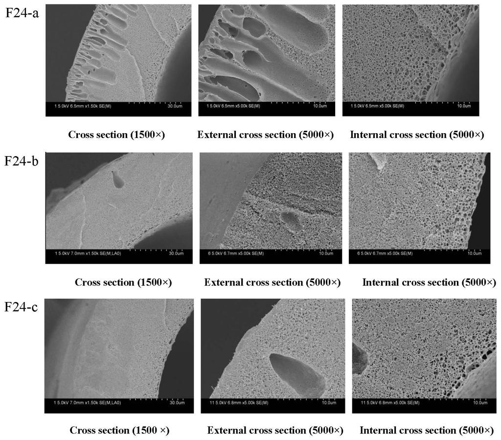 Membranes 2014, 4 90 finger-like pores are present near the outer walls of the hollow fiber membranes, while sponge-like structures are possessed by the center of the hollow fiber membranes and the