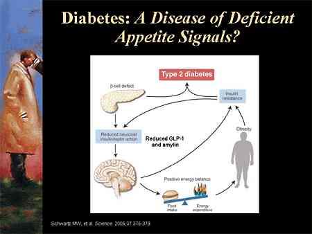 Type 2 Diabetes: A Disease of Deficient Appetite Signals?