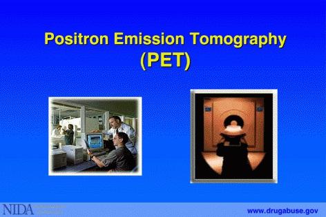 Section II 1: Measuring brain activity in response to drug use Position Emission Tomography (PET) measures emissions from radioactivelylabeled chemicals that have been injected into the bloodstream,