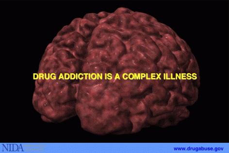 Drug addiction is a complex illness. The path to drug addiction begins with the act of taking drugs. Over time, a person's ability to choose not to take drugs is compromised.