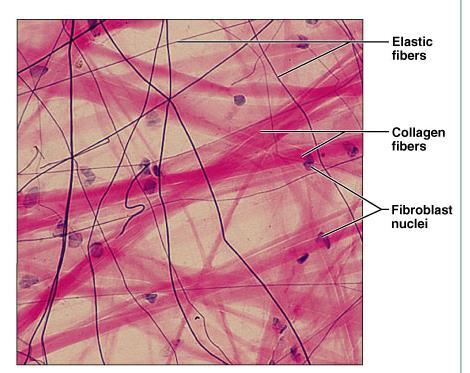 Proper connective tissue 1- Loose (Areolar) connective tissue Gel-like matrix with all three connective tissue fibers Cells: Fibroblasts,