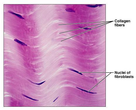 2- Dense connective tissue A- Regular Dense CT: Parallel collagen fibers with a