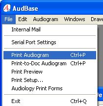 8. Double click on your highlighted name in the box on the left side and the revised audiogram will be resent to the EMR. Printing Audiograms 1.