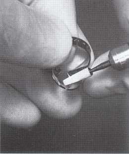 Methods of tying retainers with dental floss, except butterfly no. 212 retainer. Figure 21.