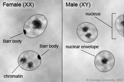 Barr body or sex chromatin: inactive X chromosome in a female somatic cell