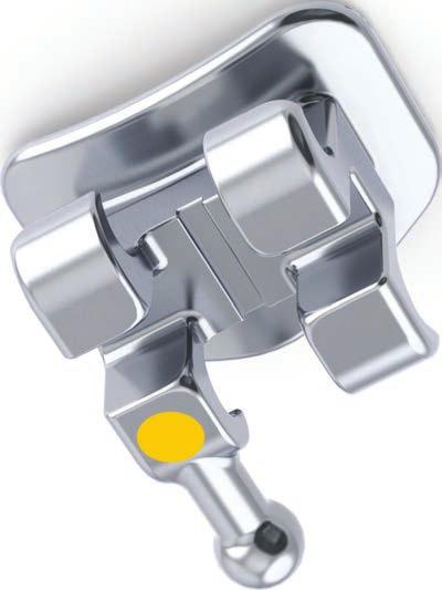 4 Metal Bracket System Integrated Ball Hook for easy engagement of elastics Colour Enhanced ID System by quadrant with a removable colour coded dot for easy selection Metal