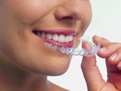 It is made especially to fit your teeth, so it is important to consult a specially-trained orthodontist who can make sure that it does exactly what you need it to do.