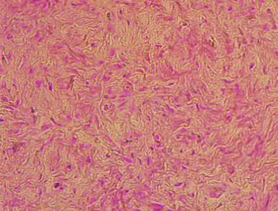 Prussian Blue BMDSC: human ovarian tissue Control BMDSC CD133+ Injected cells