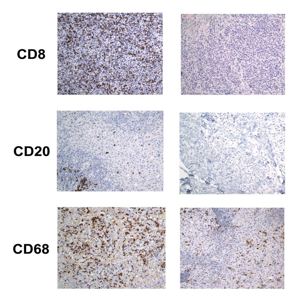 Low indicators of inflammation Why are tumors that contain activated CD8 T cell rich What are + T cells the innate immune not rejected spontaneously?