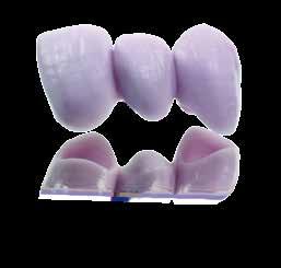 is also suitable for use in the fabrication of three-unit anterior and premolar bridges.