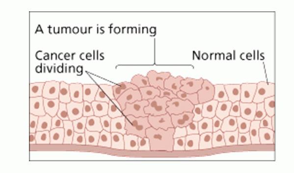 III. CANCER Uncontrolled cell growth A.