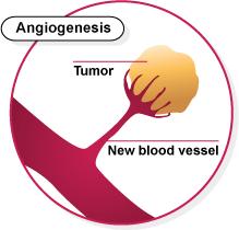 b. Cancerous cells affect the