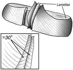 The transverse processes extend out on either side of the laminae. The spinous process is the bony projection that can be felt through the back of someone's skin.