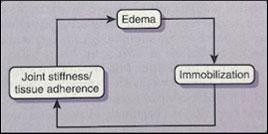 Acute Stiffness Chronic Stiffness Inflammation Aggressive edema management vs.